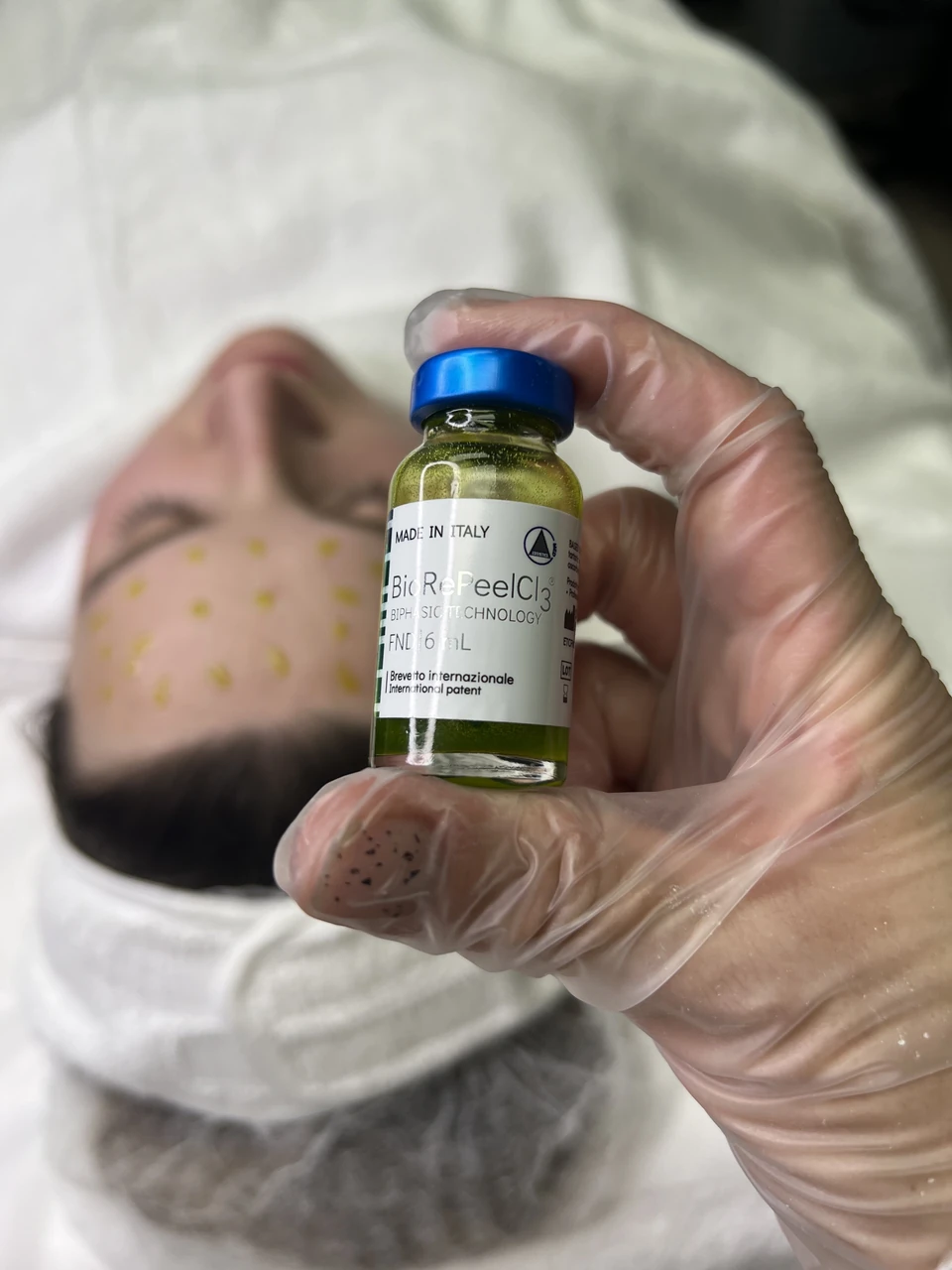 A BioRePeelCl3 vial held beside a treatment bed at BE SPACE.