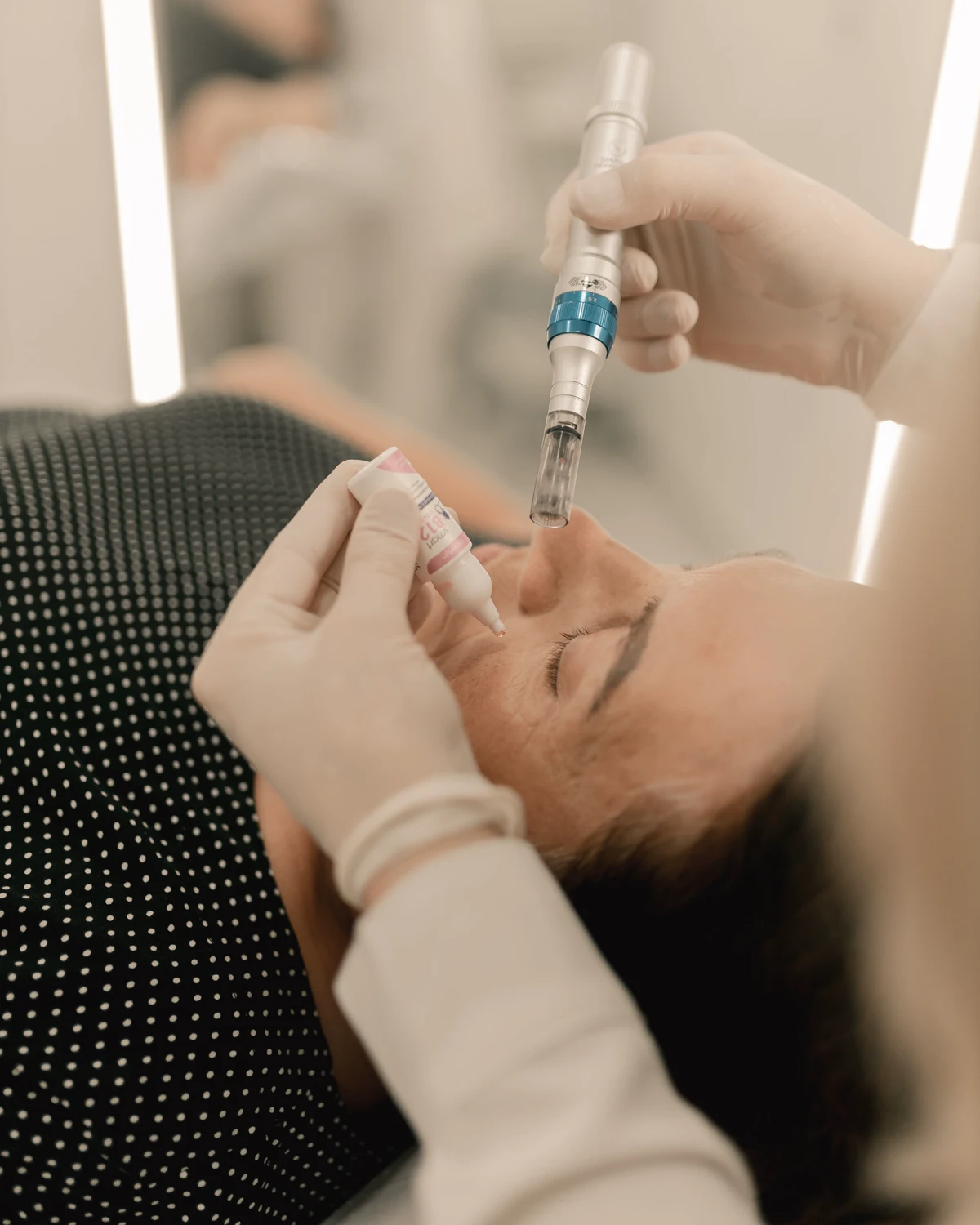 A microneedling device held above a client's face during treatment.